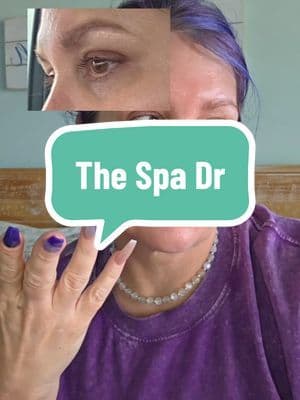 The Spa Dr. Youthful Eye Cream Resluts vary but you could see with just 2 weeks of consistency. #thespadr #youthfuleyecream #over40skincare #eyecream #tiktokshopcreatorpicks