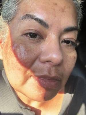 The morning after sleeping with the @Sungboon Editor Official #deepcollagenmask #glowyskin #glassskin #dealsfordays #tiktokshopfind #tiktokmusthaves #summerdeals #tiktokshopmusthaves #ttshop