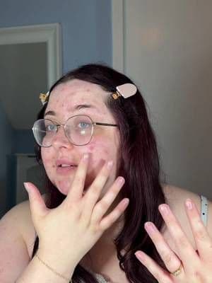 #AD– Gifted (and yes, I have to say that, but stay with me) Dermatillomania is real and so are these sore patches. The one product genuinely helping me soothe them right now is @MEDIHEAL_UK Madecassoside blemish pads. Now, Mediheal did gift me a bunch of their range, so I’m declaring it properly. But I’ve already made the content I owed them. This isn’t that. I’m sharing these completely off my own back because out of everything I was sent, these are the one thing I keep actually reaching for to calm the raw, sore areas down and it really stood out to me so I had to share 🩵