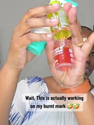 Couple Weeks ago I got a burn on my forehead from Hot Oil and look at it now!!! @PURITO SEOUL #purito #puritoseoul #fyp #tiktokshop #tiktokshopcybermonday