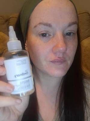 Stop Wasting Money on Skincare That Doesn’t Work! 🛑✨ If you’re tired of skincare routines that promise the world and deliver nothing, this is for you. 💆♀️ The Ordinary is my absolute safe place for flawless, glowing, glass skin. Simple steps, powerful formulas, and real results that speak for themselves. Don't miss out #tiktokshopfinds #tiktokshopuk #tiktokmademebuyit #tiktokshopdeals #buynow @The Ordinary Store UK
