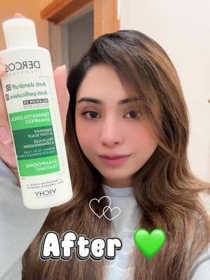 The Dercos Confidence Comeback 🫶🏻♥️ #DercosConfidenceClub #ad #LorealistarUK #DercosConfidenceClub #haircare @Vichy L