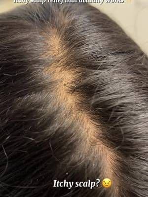 I received Head & Shoulders Bare itchy scalp relief serum from Influenster to try and share my honest opinion. My daughter has an itchy, dry scalp with dandruff, and this serum really helped calmed her scalp. The texture is lightweight, non-greasy, and it doesn’t feel sticky at all, which makes it comfortable for daily use. It absorbs quickly without affecting her hair. She loves the cooling, soothing feeling. It gives a refreshing, almost minty sensation that feels relaxing. The scent is light and pleasant, not overpowering. It’s very easy to use, especially science it doesn’t need to be rinsed, and we use it between washes. The ingredients feel gentle on the scalp and are designed to help with itch relief while keeping the scalp moisturizer. Overall, it made a noticeable difference in reducing itching and improving comfort. #complimentary #MintyCoolRelief #GiftedByHeadandShoulders @influenster @Head and Shoulders