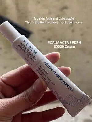 Solution to Sensitive skin ACTIVE PDRN 50000 Cream from @P.CALM GLOBAL . Get yours from @YesStyle use discount code:AVIDILLIAN00 to save $$ #PCALM #PCALMpdrn #yesstyle #kbeauty #KoreanSkincare