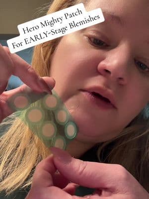 Meet HERO MightyPatch for early stage blemishes! @Hero Cosmetics #ad #skin #skincare #pimplepatch #mightypatch With ~ Salicylic Acid & Cica