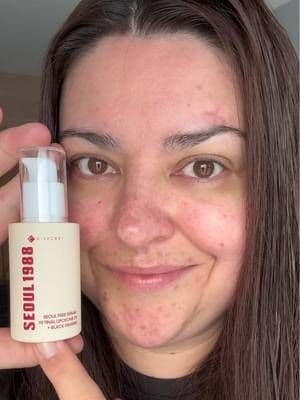 Just 7 days? Keeping it real with my skin journey ✨ I’ve been trying out the Seoul 1988 Retinal Serum (2% Retinal Liposome + Black Ginseng) for the past 7 days to target some of my main skin concerns: • Hyperpigmentation due to PCOS • Problematic, reactive skin • Early signs of ageing (hello, fine lines!) • Darker under-eye area This serum contains retinal, a potent form of Vitamin A, known to work faster and more gently than traditional retinol. The texture is lightweight, smooths beautifully into the skin, and I’ve definitely noticed my complexion looking more even, calm, and brighter after just a week of consistent use! If you’re looking for a beginner-friendly retinal that’s effective yet gentle, this could be your new skincare hero. 🛍️ You can find it at YesStyle - don’t forget to use my code SAFJB5OF to save some extra coins! @KSECRET GLOBAL #ad #gifted #skincare #skintok #kbeauty #koreanskincare #skincareroutine #7days #retinalserum #acneserum #poreserum #rednessserum #Glow_With_Ania