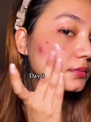 ONE DROP, Dark Spot OUT : TXA 6% + Niacinamide 10% + Retinal โข 16% Triple Active for Dark Spots #Purito #puritoTXAserum #darkspots #koreanskincare #paidpartnership @PURITO SEOUL