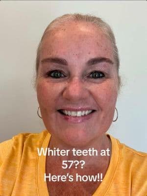 💜✨ Whiter teeth in 2 minutes? Yes, it’s a thing—and it’s peroxide-free! 💜✨ I’m 57, and whitening hasn’t been easy, especially with a bonded front tooth that strips just don’t work on. But this gentle purple whitening powder from @MySmile_US really surprised me. From the first use, I noticed a brighter smile—and no weird contrast with my bonded tooth (finally!). It’s so easy: dip your toothbrush in the powder, brush for 1–3 minutes, rinse, and you’re done. No mess, no sensitivity, no peroxide. It’s handcrafted with safe, natural ingredients and helps cancel yellow tones using a clever purple dye. Plus, it supports overall oral health, is fluoride-free, and leaves your mouth minty fresh. 🦷💜 🛒 Grab it here: https://amzn.to/4fjjmLQ #Ad #Gifted #SmileCare #NaturalWhitening #TeethWhitening #WomenOver50 #BeautyOver50 #ThisIs57 #Over50Beauty #MidlifeBeauty #MidlifeLifestyle #BondedToothFriendly #PeroxideFreeWhitening #MatureBeauty #AgelessBeauty #WellnessOver50 #MintyFresh #RadiantAtAnyAge #Over50Style #PurpleWhiteningPowder #NonSensitiveWhitening