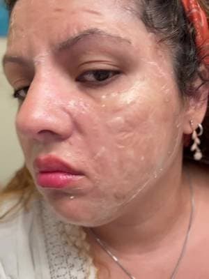 SKIN1004 Zombie Pack Power = efecto spa en casa. #SKIN1004, #tiktokshopcreatorpicks, #koreanskincare, #centella, #skincare @SKIN1004 US
