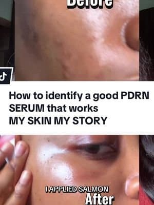 My skin my story ✨Here is why some PDRN serum doesn't work. Product mentioned: MedicubePDRN Pink Peptide Serum. #medicube #amazon #amazonmusthaves #pdrn #kojicacid @medicube global @medicube_official