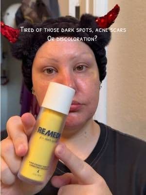 @Remedy Science #remedy #nightimeskincareroutine #skincareroutine #skincareproducts #skincare101 #darkspots #acnescars #discoloration #skincaretiktok #nighttimeroutine #tiktokshop #tiktokshopping #tiktokshopsummersale #tiktokshopsummerturnup #dealsforyoudays #ttsthunderbolt
