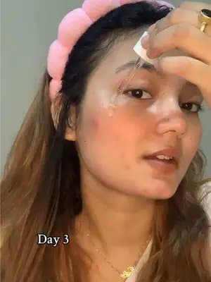 Glow where it matters ✨ Tried this Tone Brightening Ampoule and my skin feels instantly brighter and smoother 🌸 🌿 Fades dullness & evens out skin tone 💧 Helps reduce fine lines & signs of aging ✨ Hydrates & gives that soft, dewy glow #goviralwithskin1004challenge #skin1004white #tiktokmademebuyit #skincareroutine #kbeauty @SKIN1004 US @skin1004_influencers