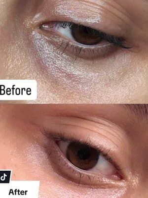 Reverting age with this magical eye cream💖💖 Product: 🍀 KSECRET Seoul 1988 Retinal Eye Cream @KSECRET GLOBAL #ksecret #fyp #fypage #eyecream #retinal #1988✅ #viraleyecream #collaboration #glowupwithretinalchallange #conten