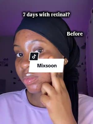 Do not use retinal only! #mixsoon #PDRNRetinalSerum #Retinal #AmazonFinds #AmazonPrime @mixsoon