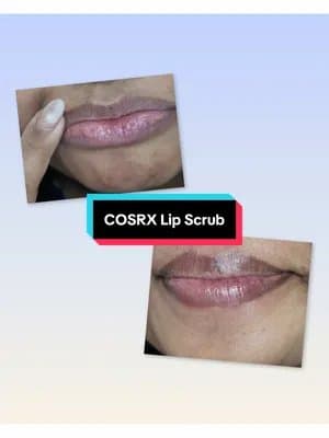 POV: You finally found a lip scrub that actually works 👀 Your lips deserve a little love too 💗 @YesStyle @YesStyleInfl