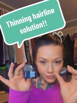 POV: your hairline said “we’re clocking back in today.” 😭👏 This is your sign to STOP stressing over thinning edges… be