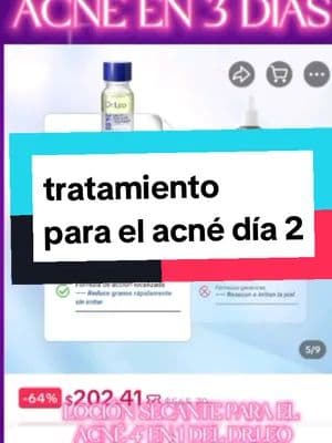 DILE ADIÓS AL ACNÉ EN TRES DÍAS TRATAMIENTO LOCIÓN SECANTE 4 EN 1 DOCTOR LEO. DÍA 2 USANDO EL TRATAMIENTO PARA EL ACNÉ. SI LO QUIERES OBTENER EL TUYO SOLAMENTE DALE CLICK AL LINK QUE TE DEJO ARRIBITA DE MI NOMBRE EN MI CARRITO NARANJA Y OPTELO CON DESCUENTO Y ENVÍO GRACIAS A TU CASA NOS VEMOS EN UN PRÓXIMO VIDEO BAY #VentaQuincenal #tratamientoparaelacne #drleo #viraltiktok #TikTokShopMx @Dr.Leo MX