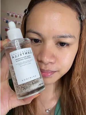 Redness won’t go away? This calms it! #GoViralWithSKIN1004Challenge #SKIN1004White #skin1004 #centella #TikTokMadeMeBuyIt @skin1004_challenge @SKIN1004 US