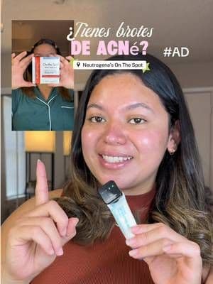 #AD ¿Tienes brotes de acné? Descubre el tratamiento para el acné con peróxido de benzoilo al 2.5% de Neutrogena, de acción rápida💗 La verdad este producto me redujo muchísimo el enrojecimiento y el acné! Gracias @Neutrogena #ad #skincare #neutrogena