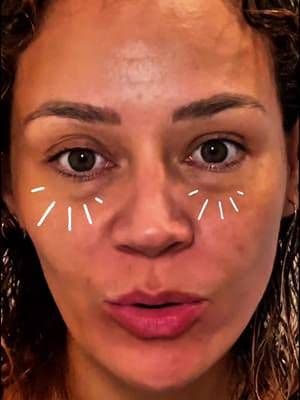 ¿Te ves cansada aunque hayas dormido bien? Mira tu contorno de ojos…#nynm #tiktokshopjumpstartsale #NewYearNewMe #anuaskincare #contornodeojos DISCLAIMER Resultados pueden variar. Producto cosmético, no es un medicamento. Usar según indicaciones y realizar prueba de sensibilidad.